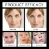 Hoygi 30ml Illuminating Face Serum Vitamin E Frankincense Essence Lightweight Radiance Booster for Dull Skin Non Sticky Formula
