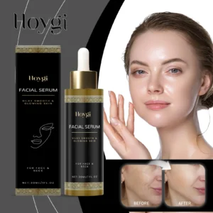 Hoygi 30ml Illuminating Face Serum Vitamin E Frankincense Essence Lightweight Radiance Booster for Dull Skin Non Sticky Formula